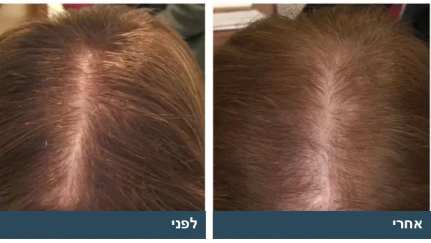 לפני / אחרי של יסמין כ׳, 71